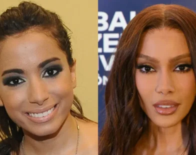 Antes e depois das cirurgias plásticas dos famosos: Os procedimentos que eles fizeram!