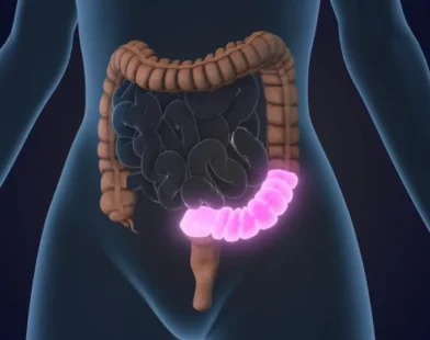 4 regras obrigatórias para proteger o intestino ao tomar antibióticos